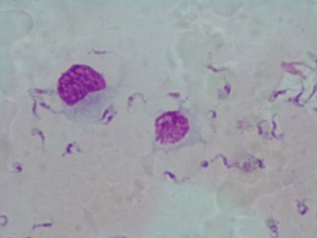 Trypanosoma Slides - Trypanosoma 03 400X
